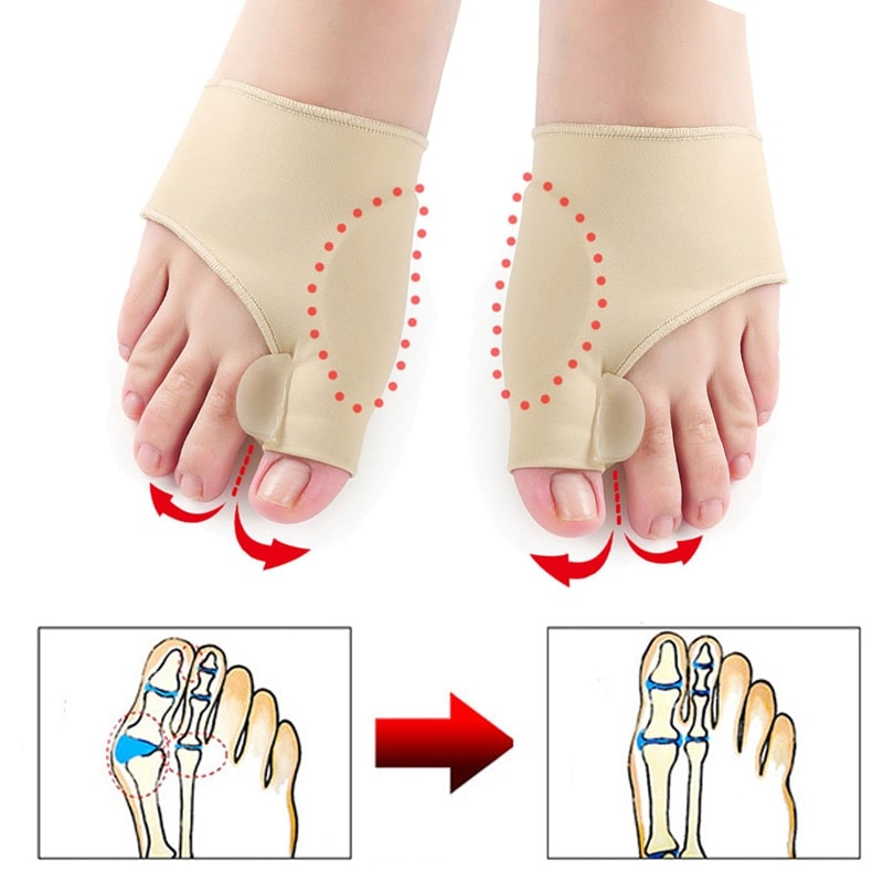 BunionCorrect™ - Eliminate Bunion Pain For Good! - 1+1 Free